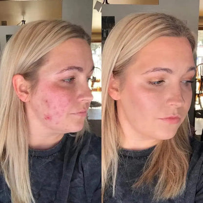 SkinMatch