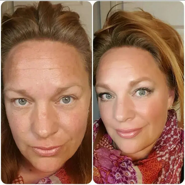 SkinMatch