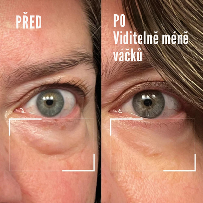 RedLift Eye