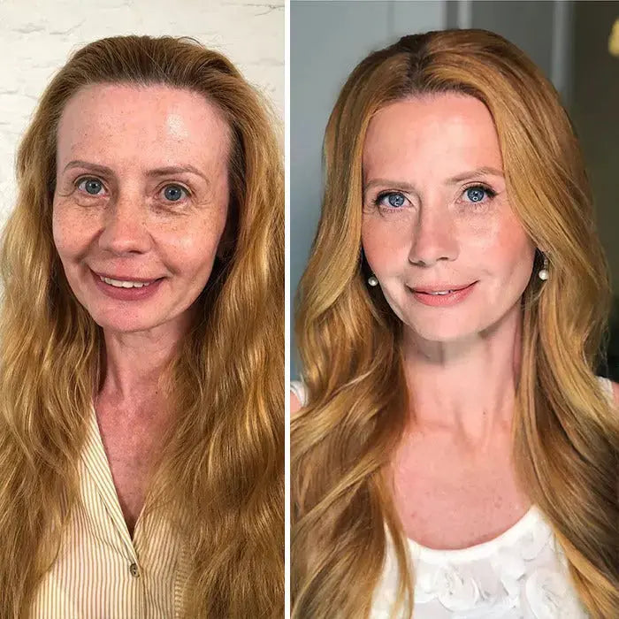SkinMatch