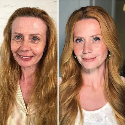 SkinMatch