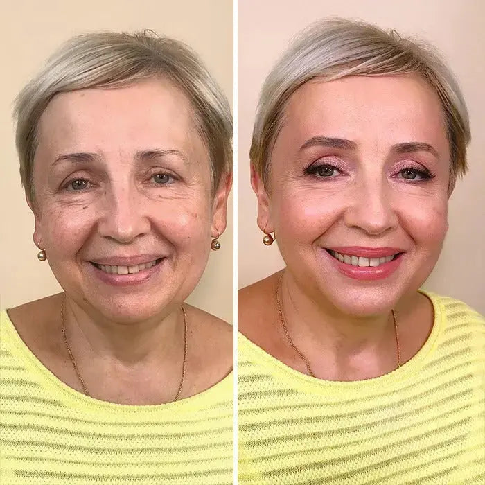 SkinMatch
