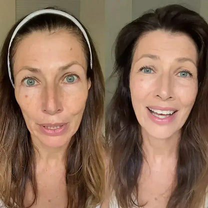 SkinMatch