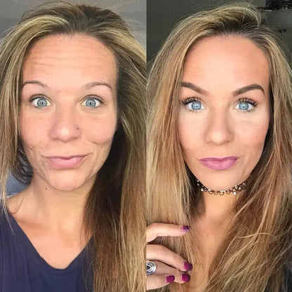 SkinMatch