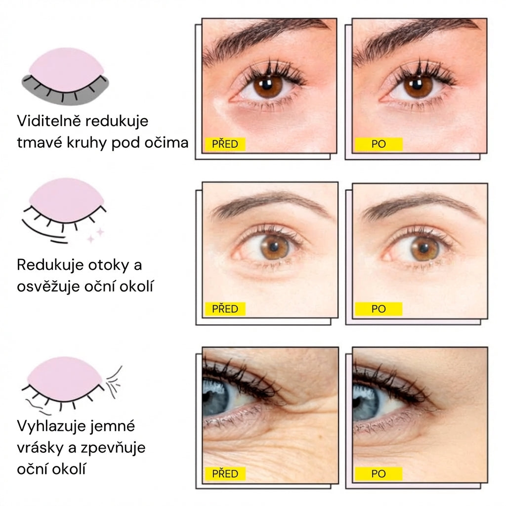 InstaLift™ – Oční patchy proti kruhům a otokům
