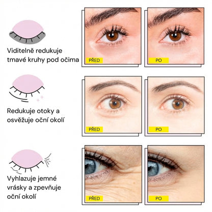 InstaLift™ – Oční patchy proti kruhům a otokům