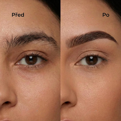 SmoothSkin