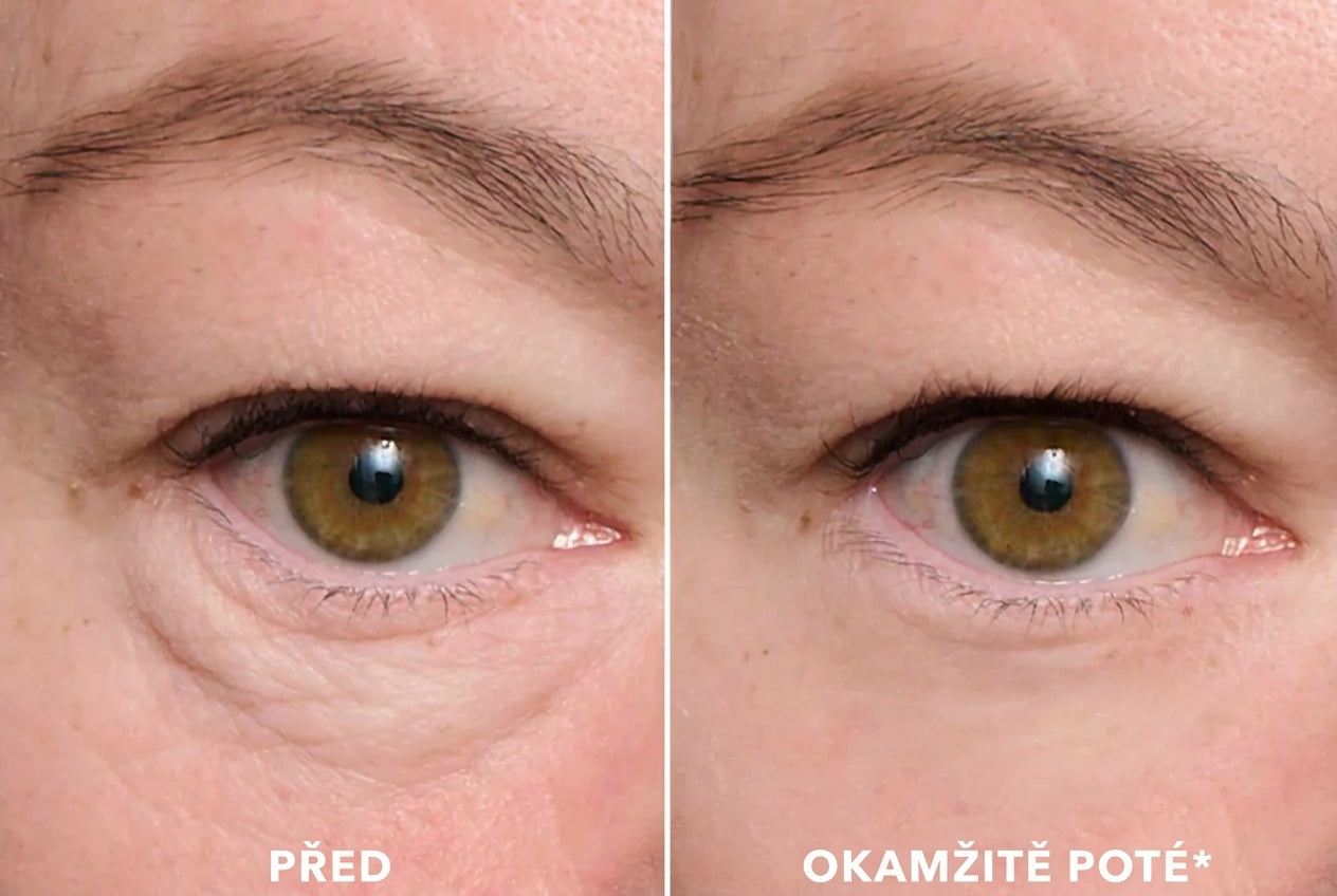 Larana EyeLift Pro