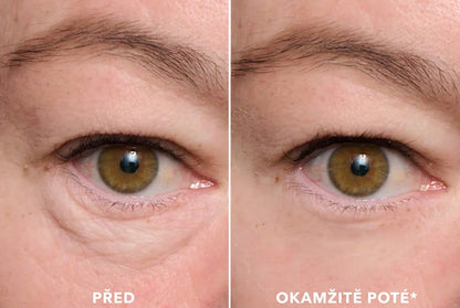 Larana EyeLift Pro