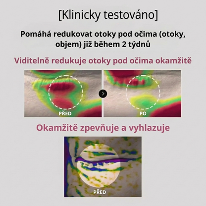 HydroLift – Oční polštářky proti otokům a kruhům