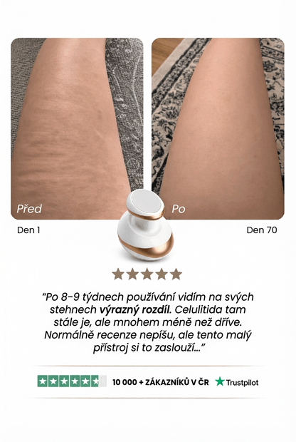 CelluLift Pro
