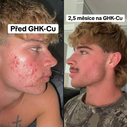 GHK-Cu regenerační sérum