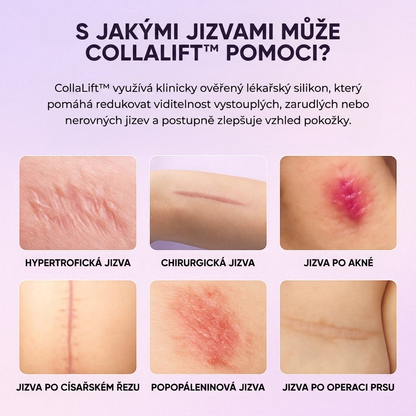 CollaLift