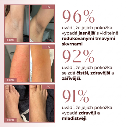 Larana SilkPeel™ — Tělový peelingový sprej s kurkumou