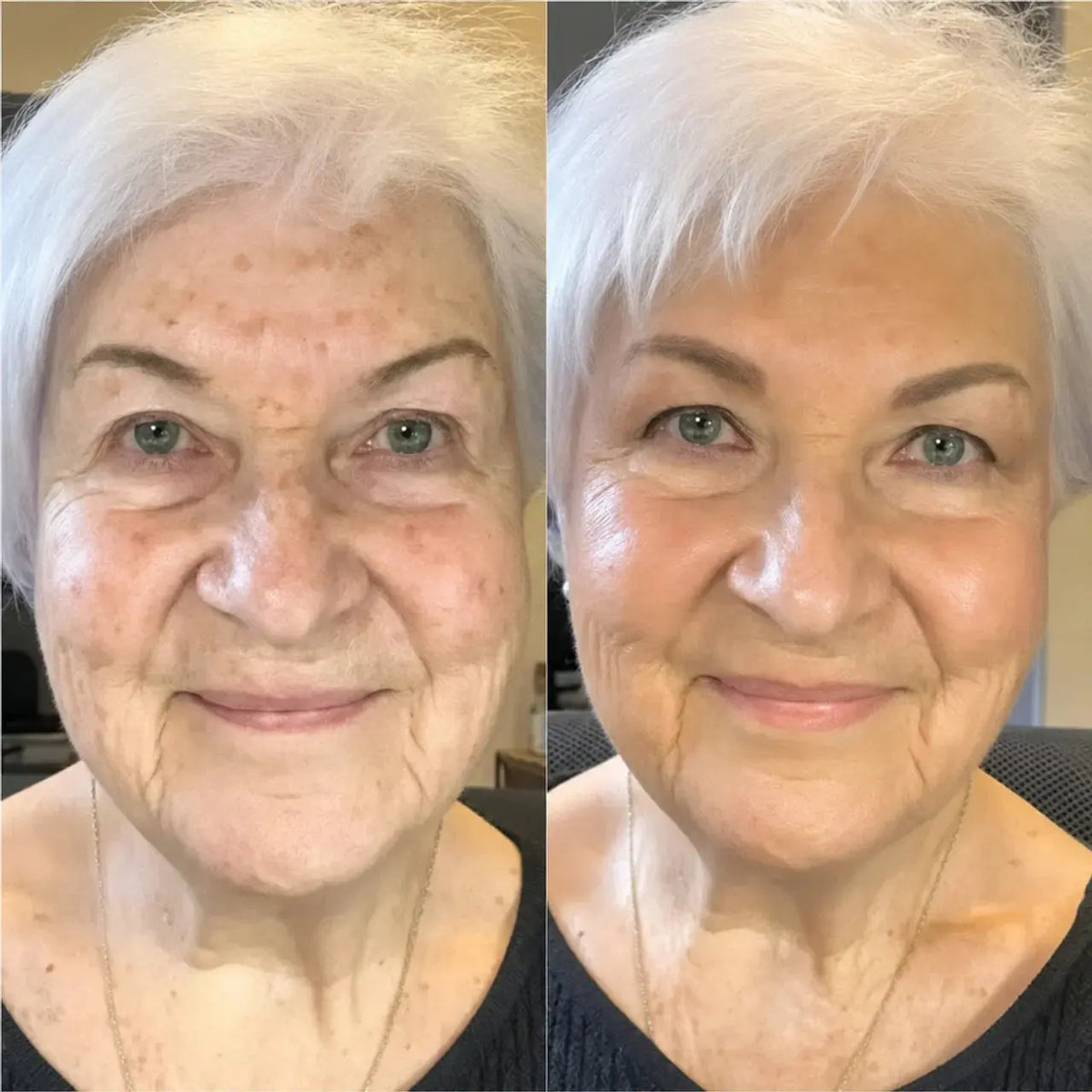 SkinMatch